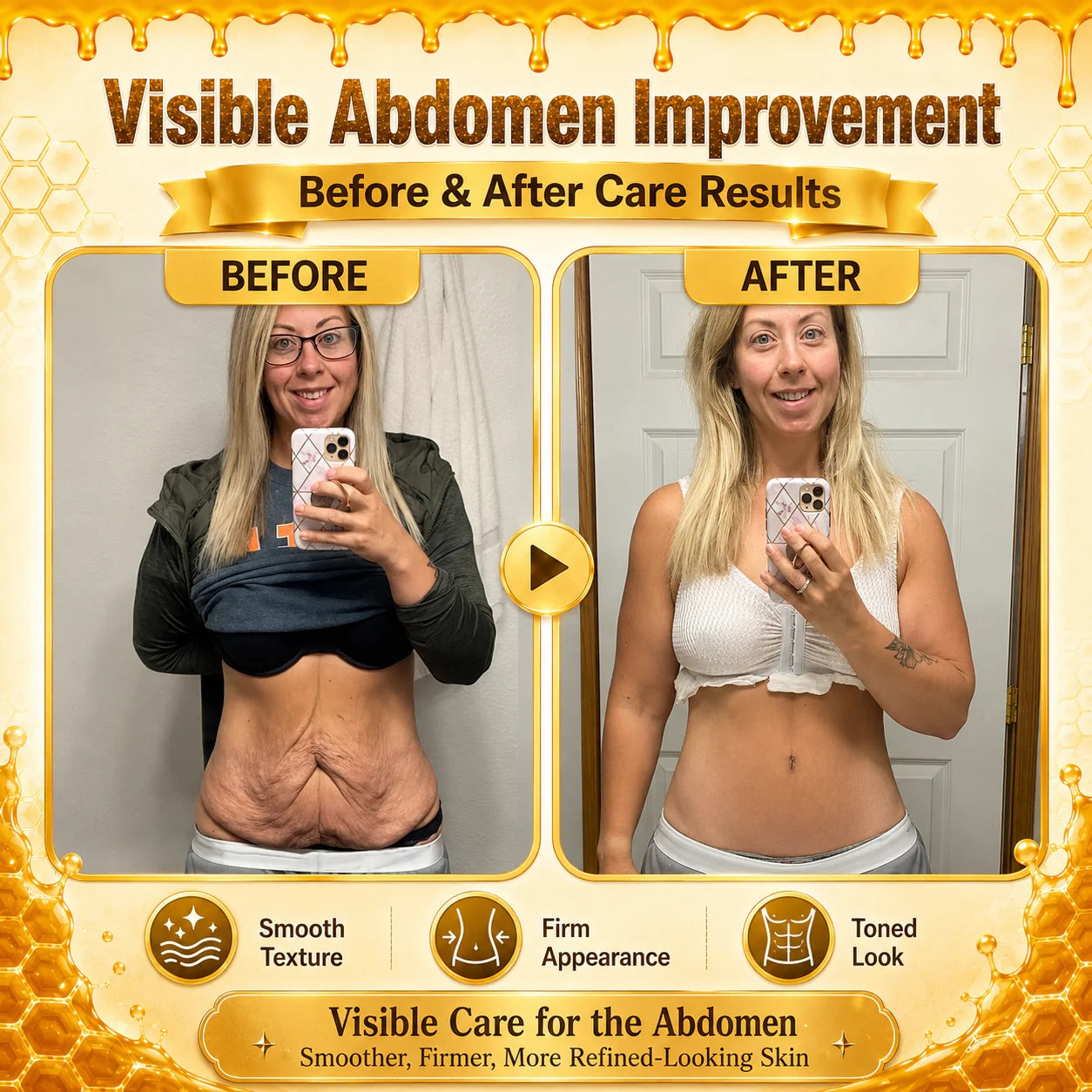 DEVIOA®   Bee Poison Skin Restoration Cream 👨‍⚕️🥇👩‍⚕️